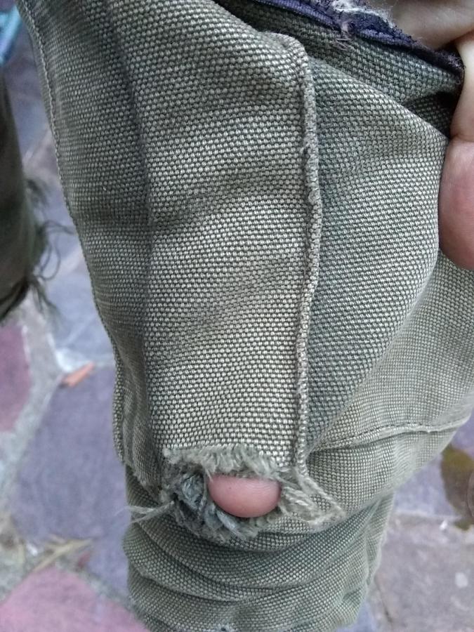 hole (with finger showing through) in pocket of jacket